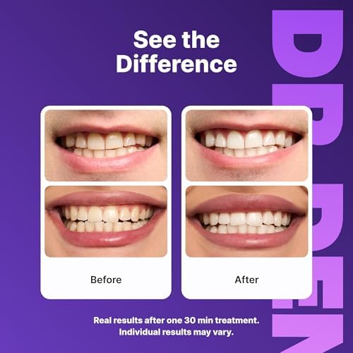 DRDENT Purple Teeth Whitening Strips 21 Treatments - Safe for Enamel - Non Sensitive Teeth Whitening - Whitening Without Any Harm - Pack of 42 Strips + Mouth Opener Included